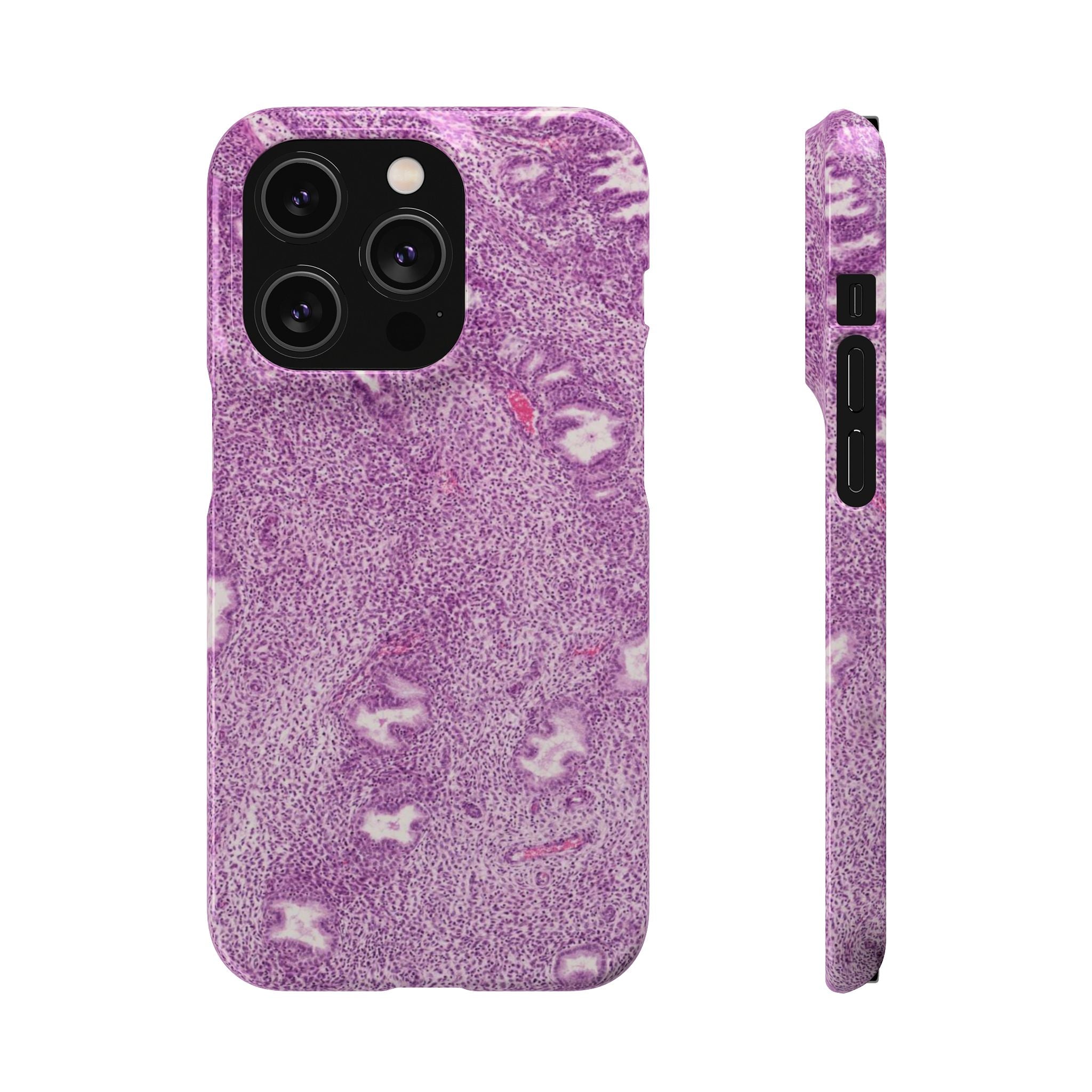 Slim Case Endometrium