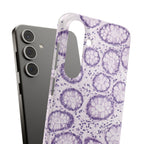 Slim Case Kolon