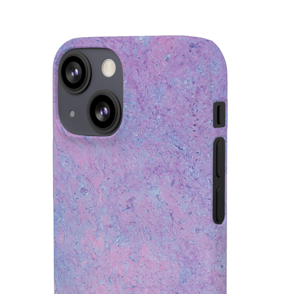 Slim Case Arterielles Myxom
