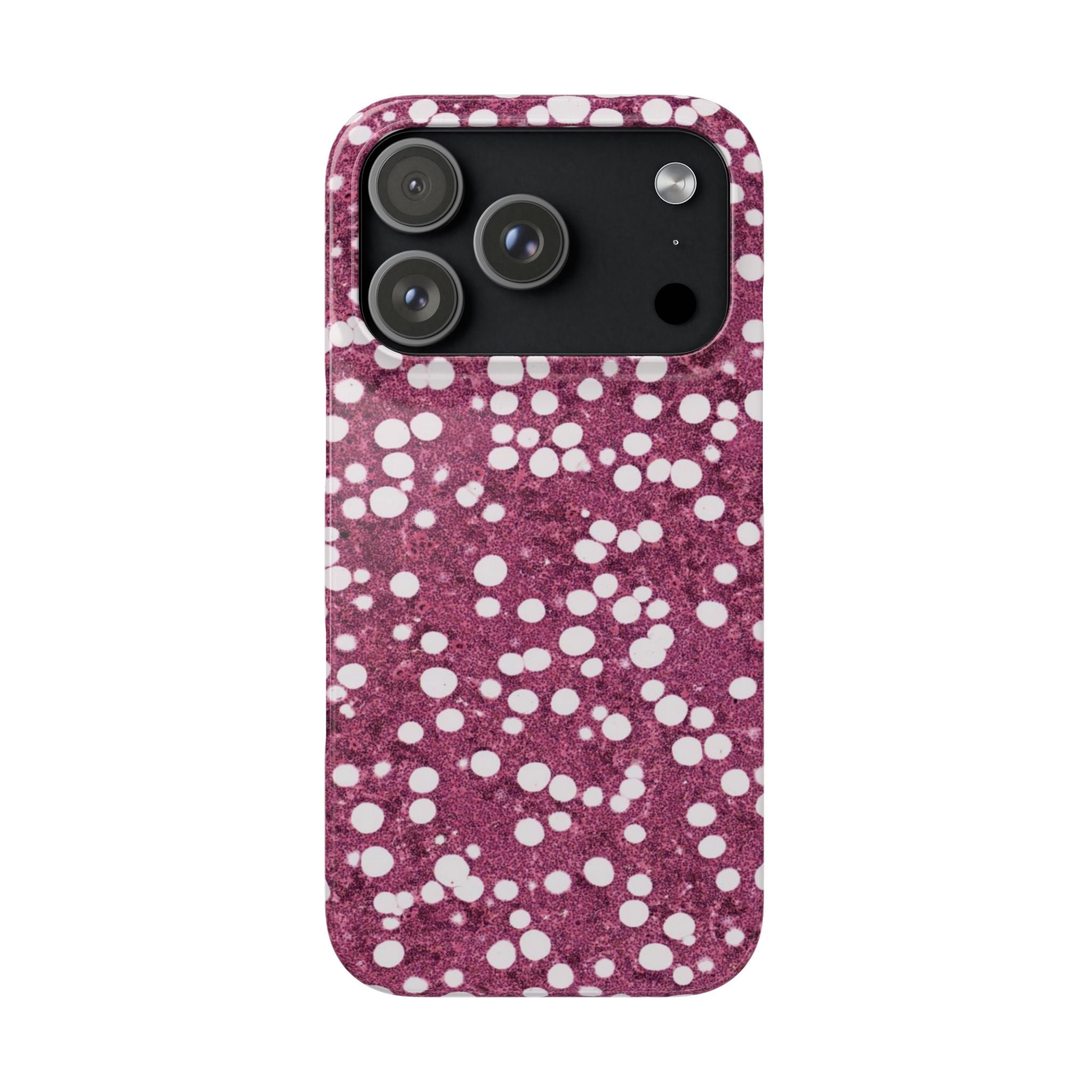 Slim Case Myelolipom