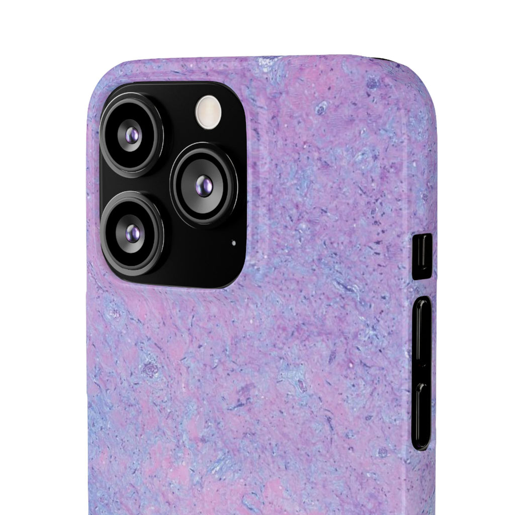 Slim Case Arterielles Myxom