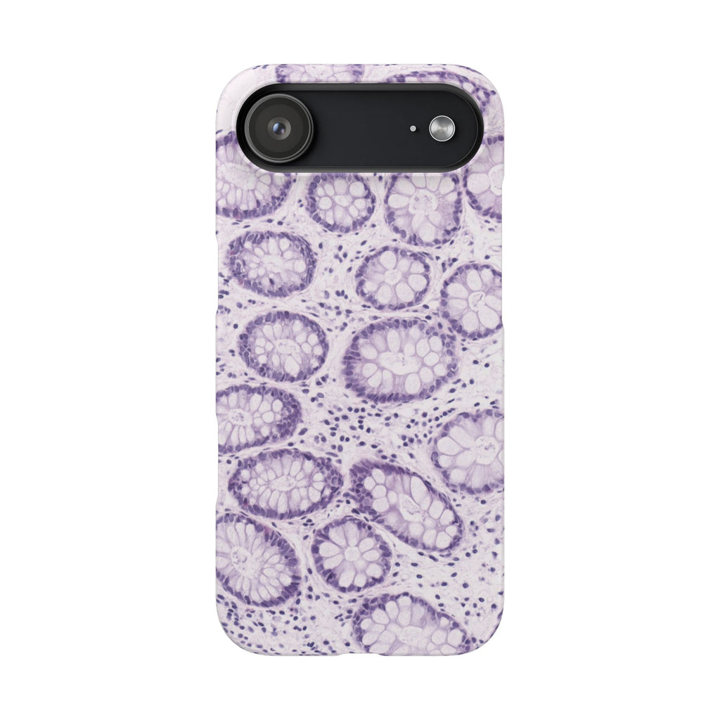 Slim Case Kolon