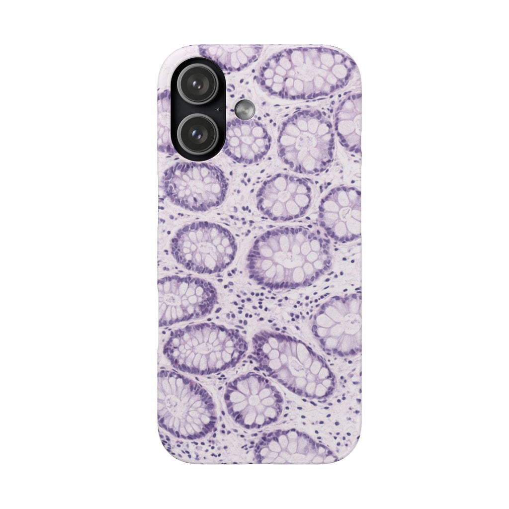 Slim Case Kolon