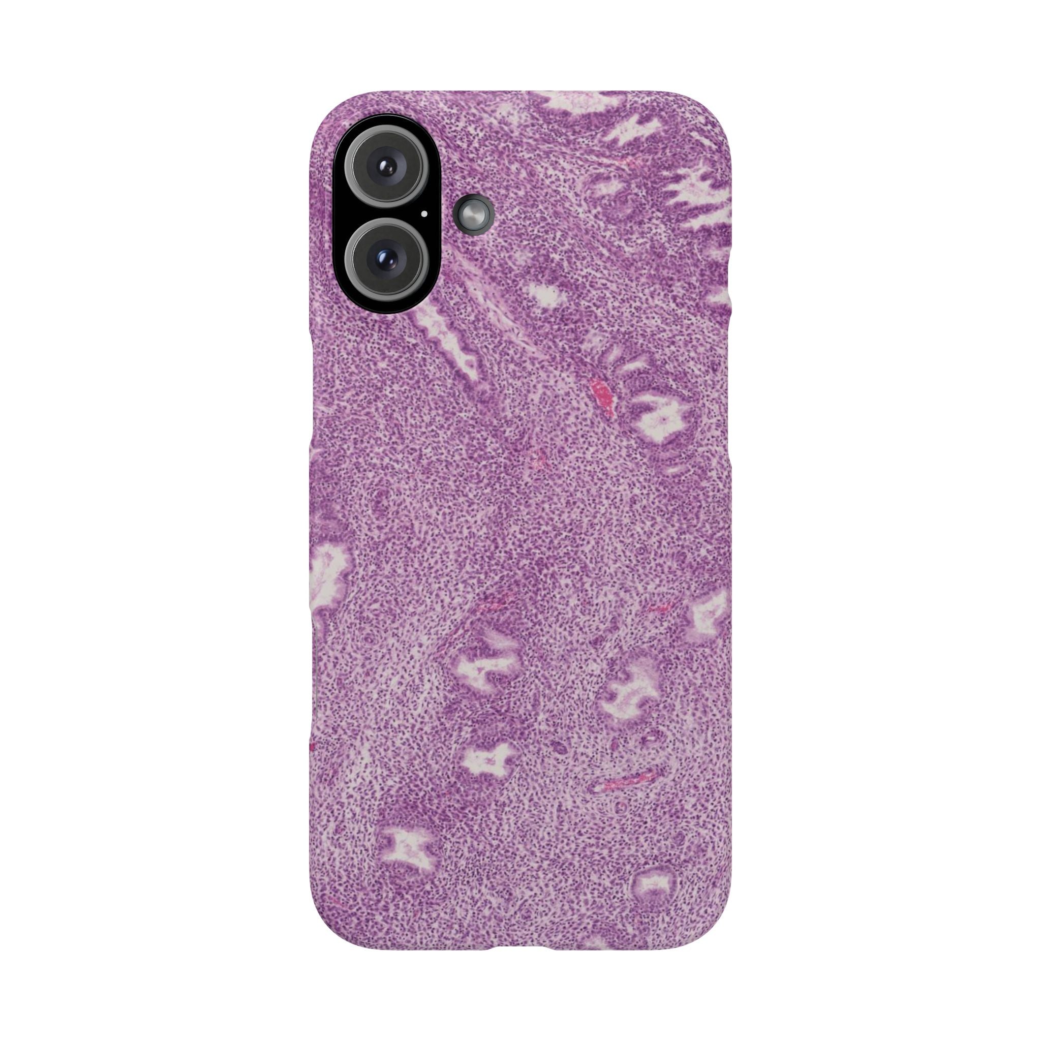 Slim Case Endometrium