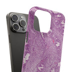 Slim Case Endometrium