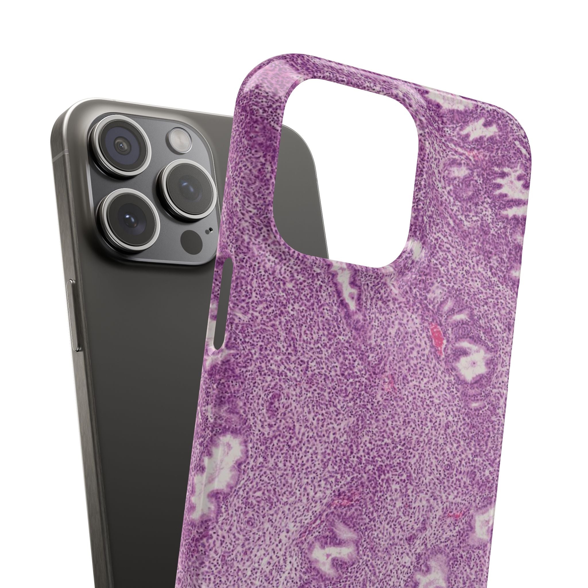 Slim Case Endometrium