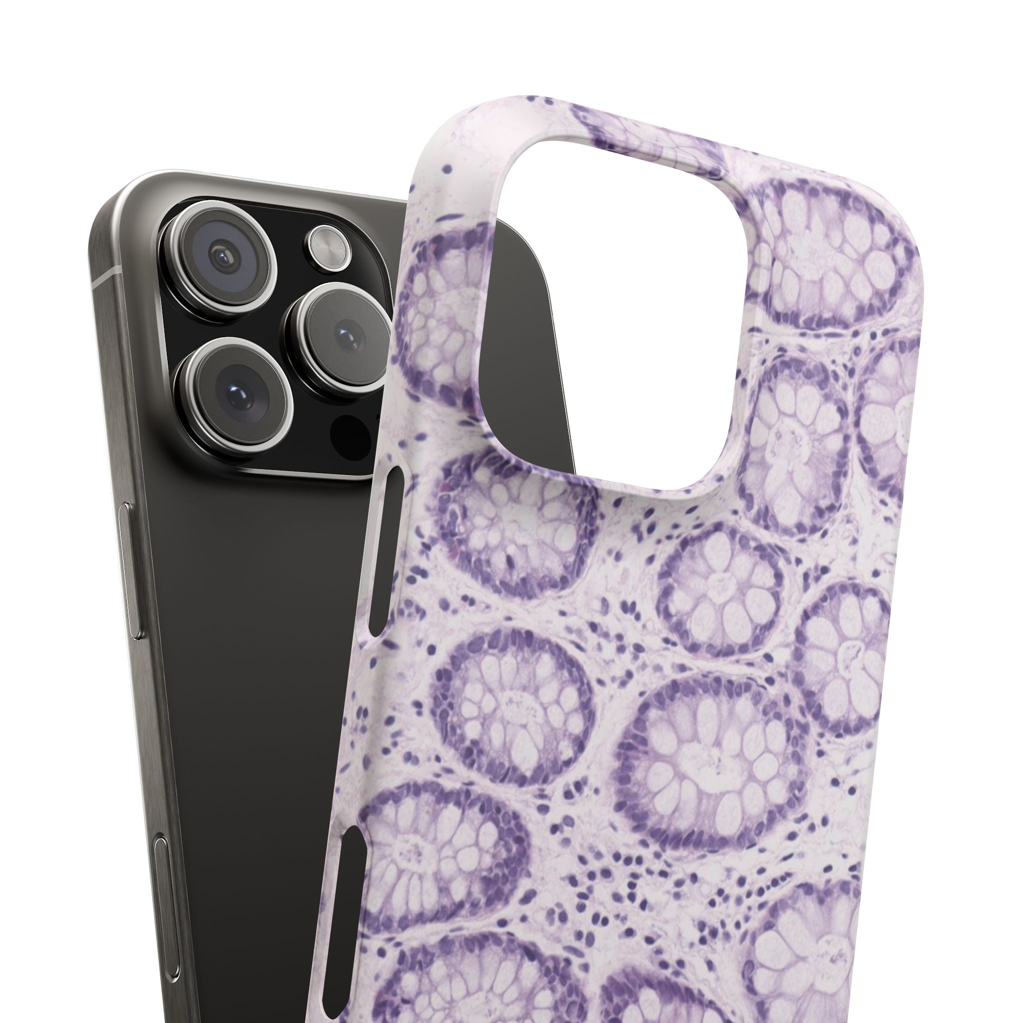 Slim Case Kolon