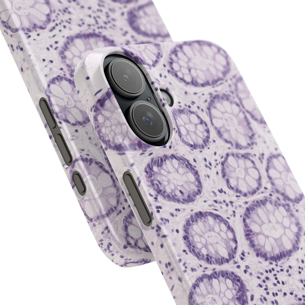 Slim Case Kolon