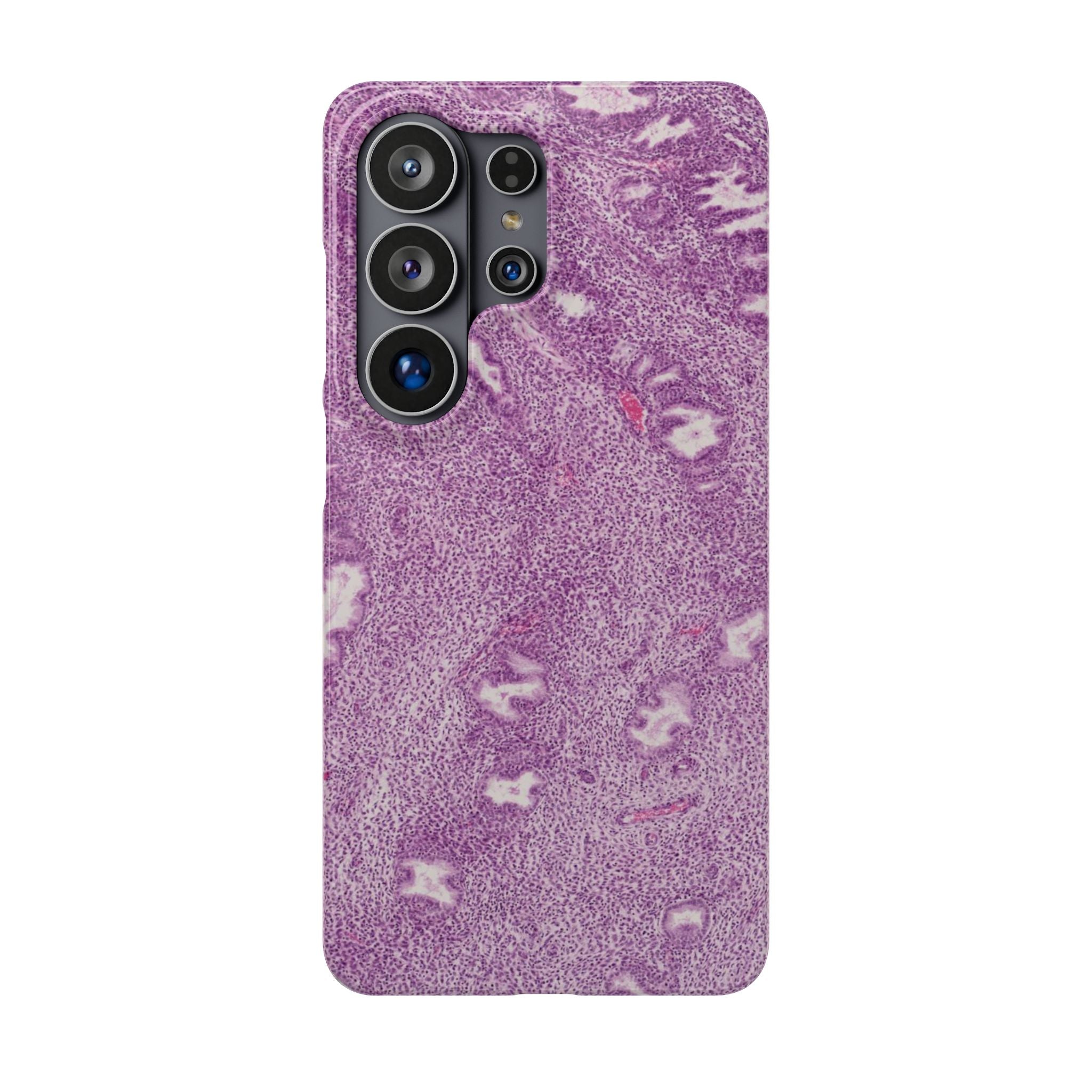 Slim Case Endometrium