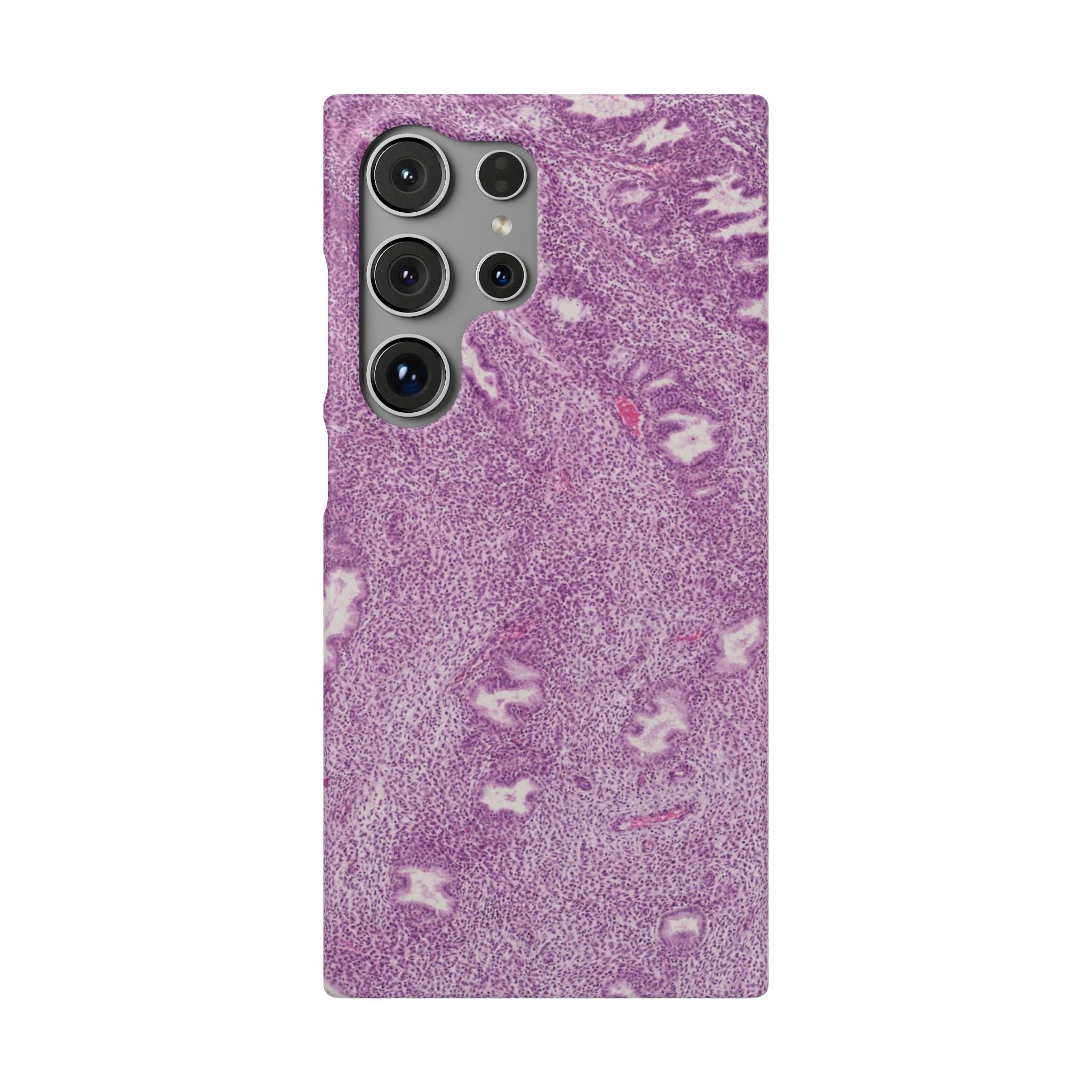 Slim Case Endometrium