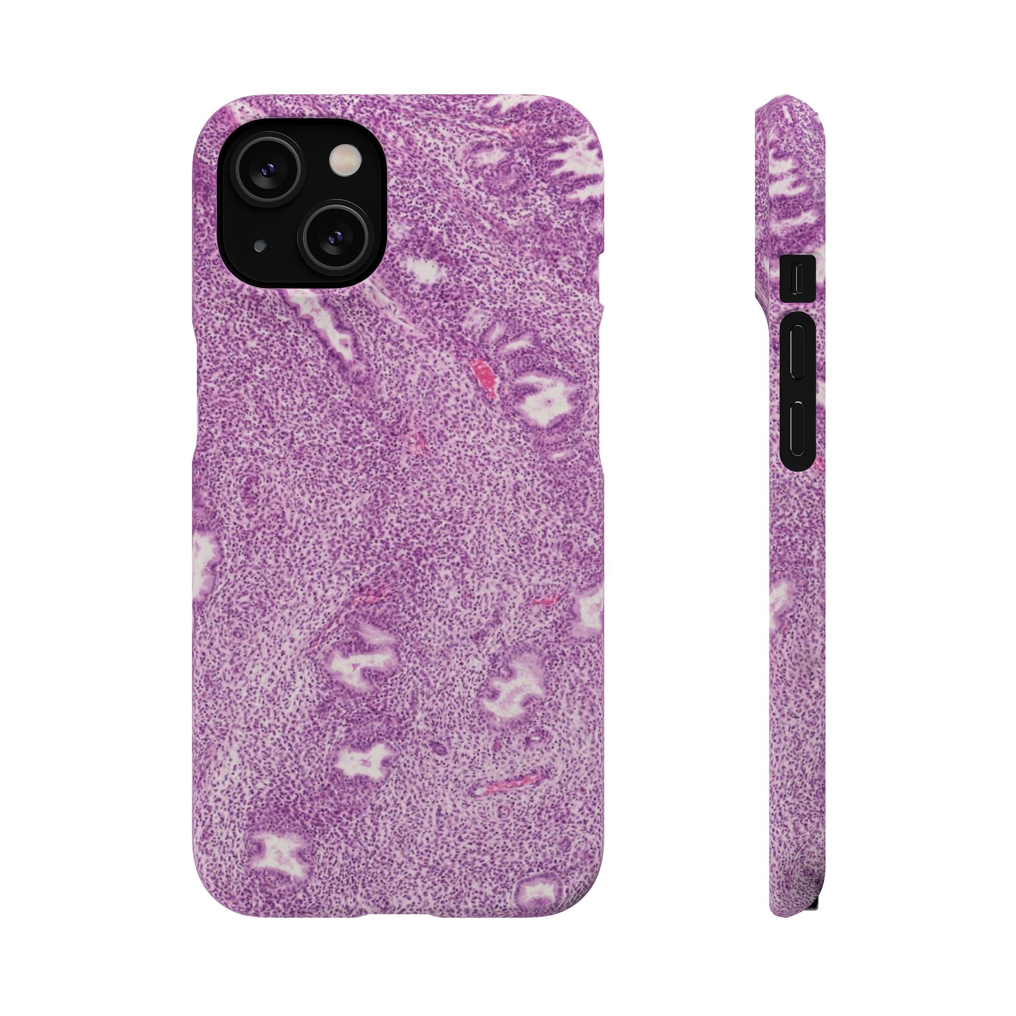 Slim Case Endometrium
