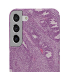 Slim Case Endometrium