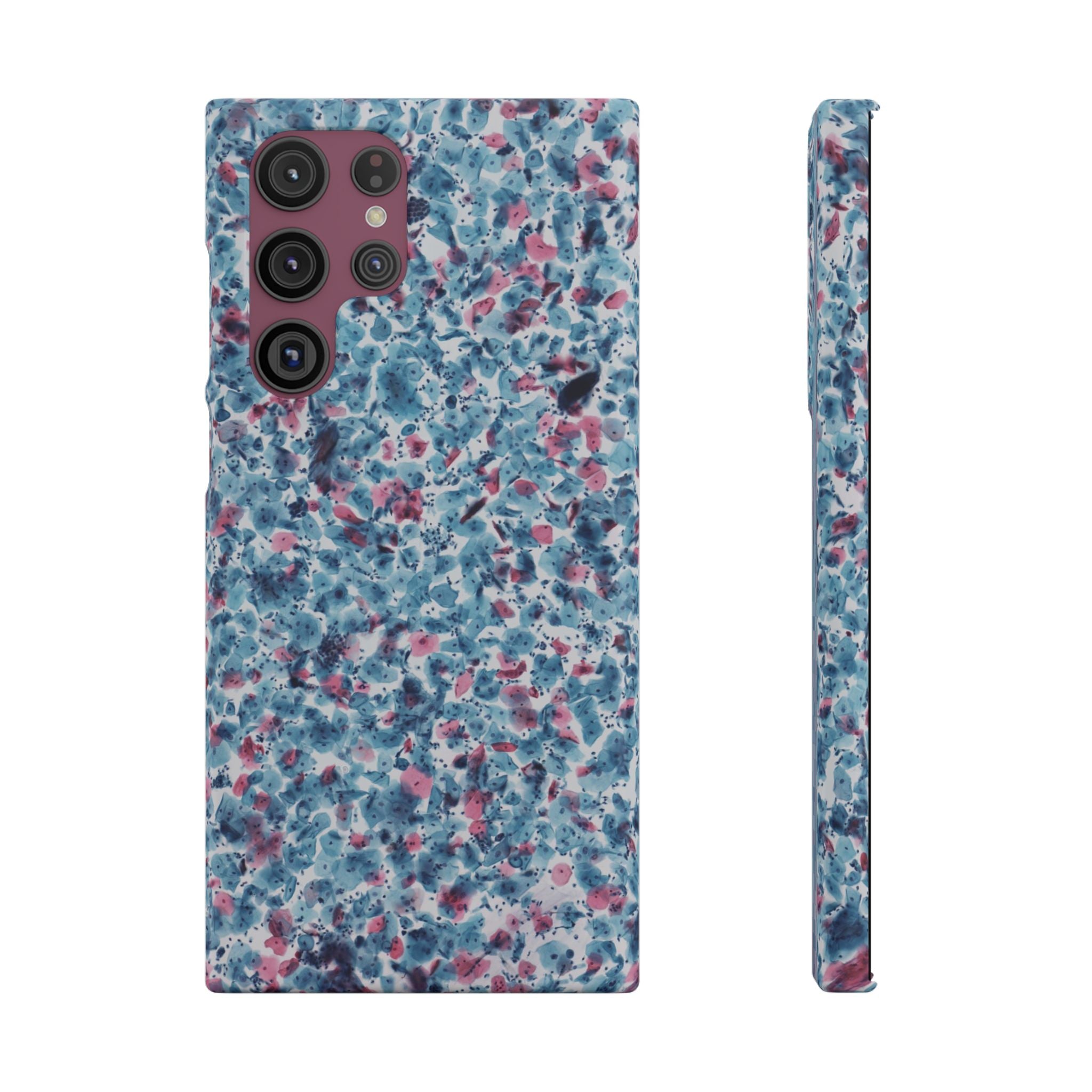 Slim Case PAP