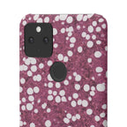 Slim Case Myelolipom
