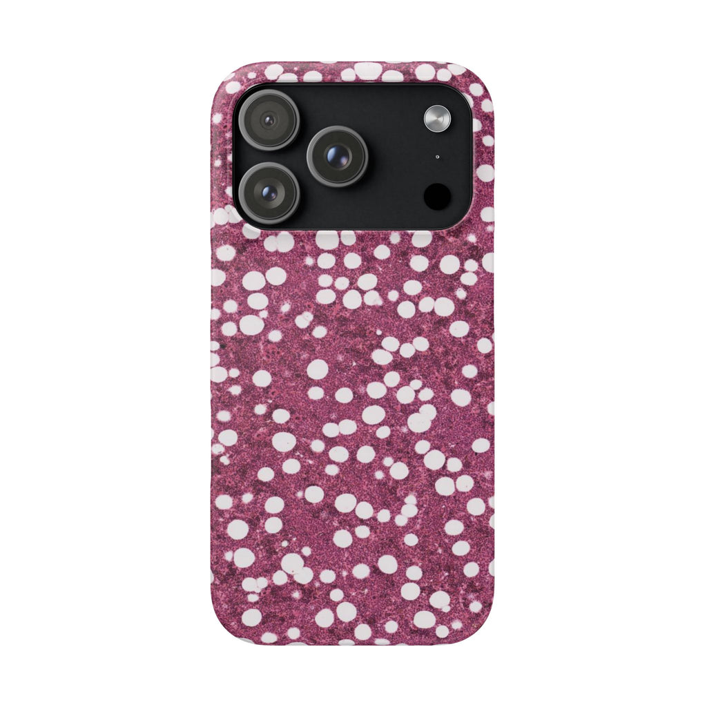 Slim Case Myelolipom