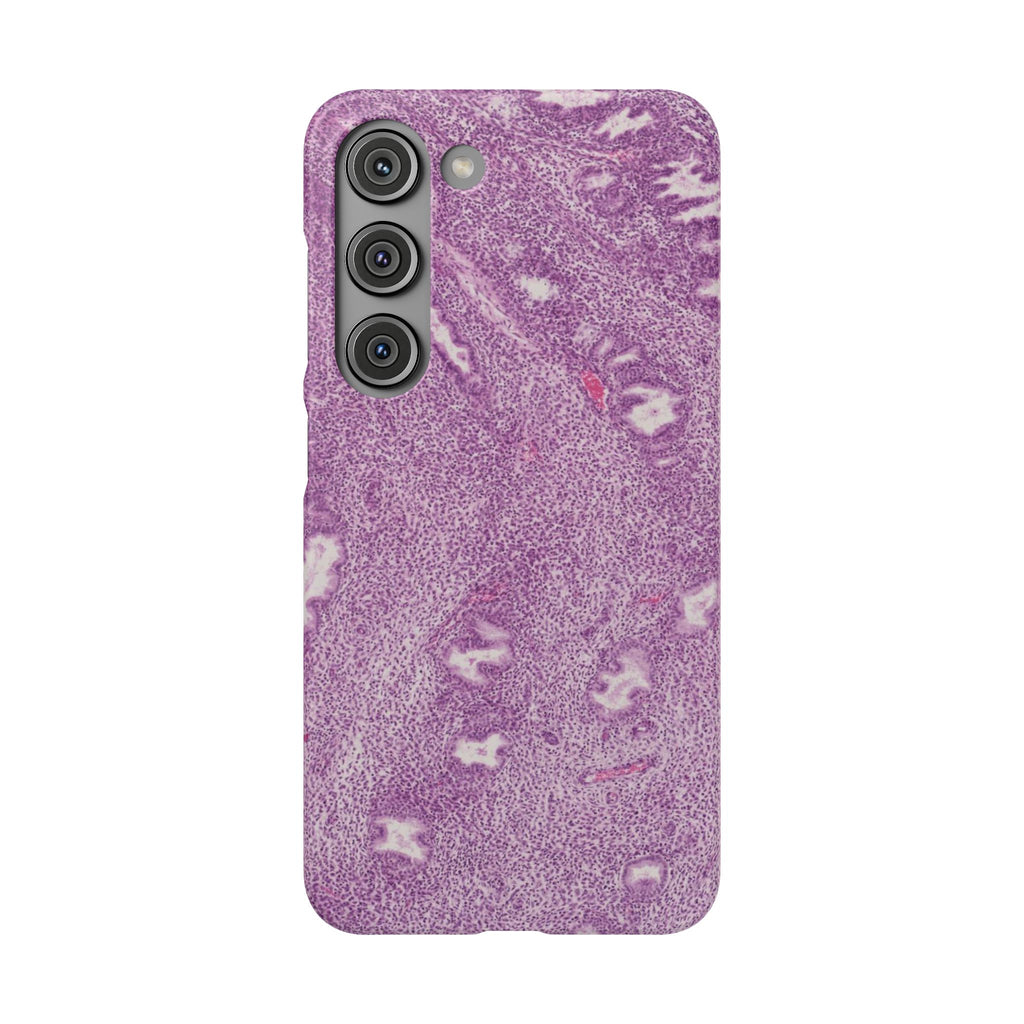 Slim Case Endometrium