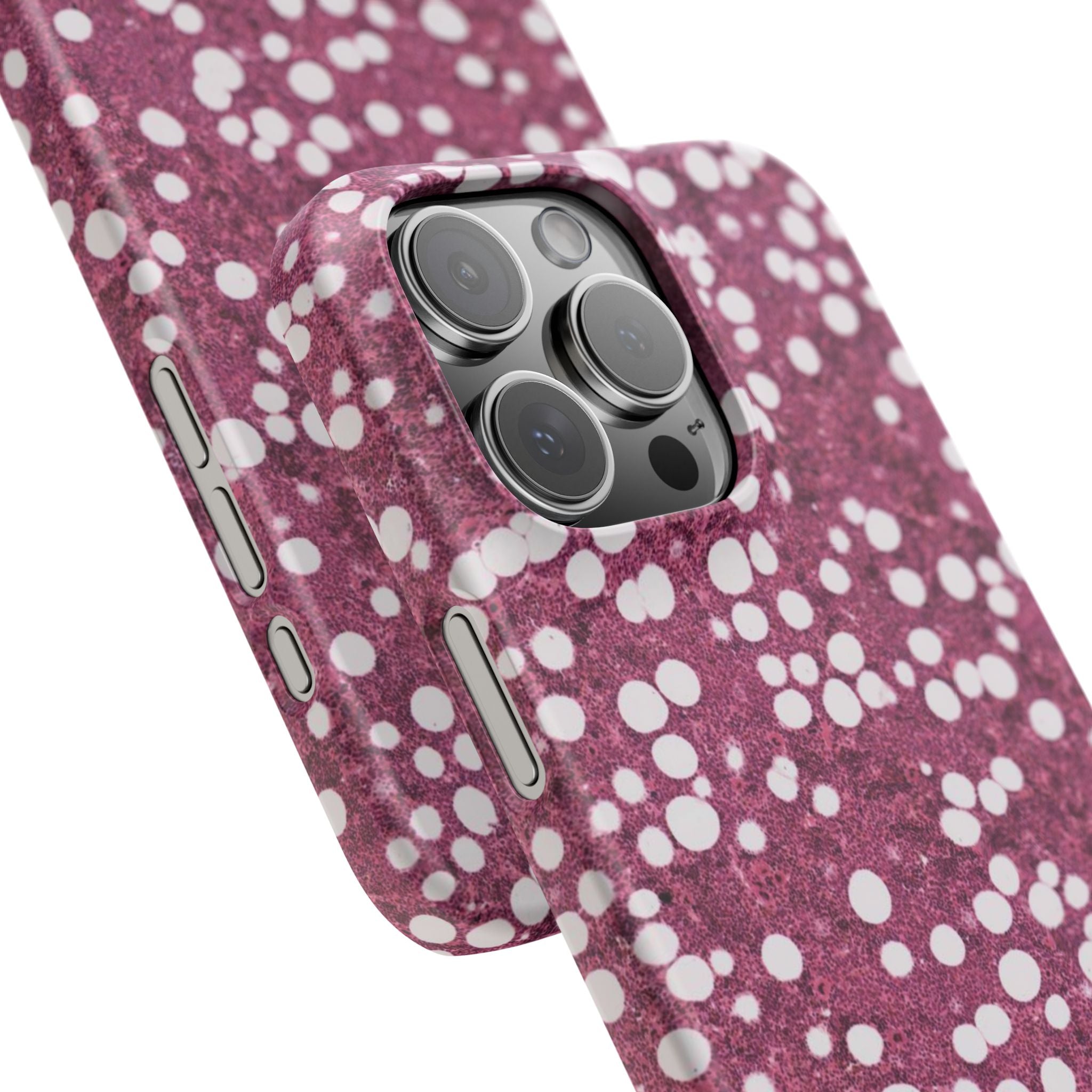 Slim Case Myelolipom