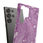 Slim Case Endometrium