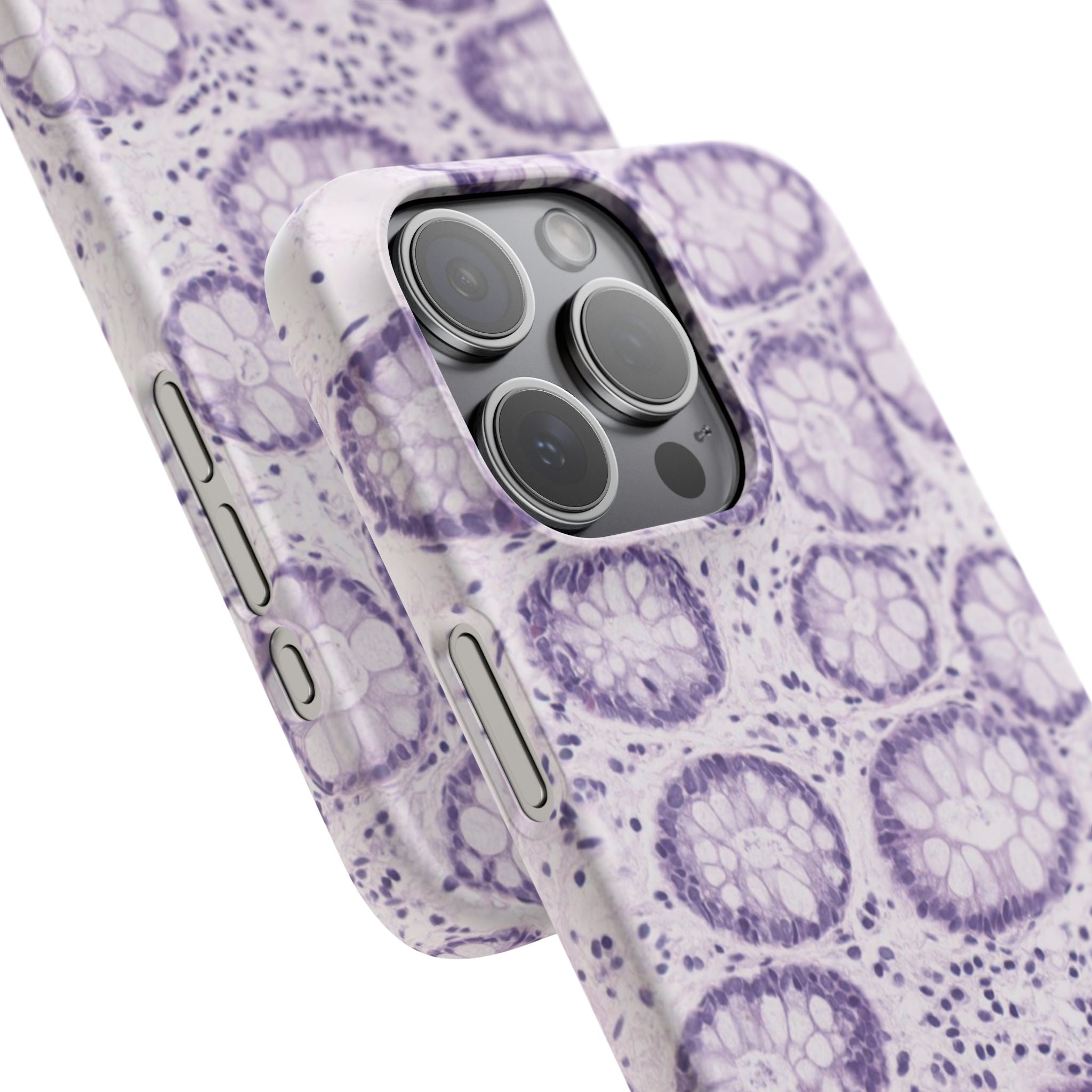 Slim Case Kolon
