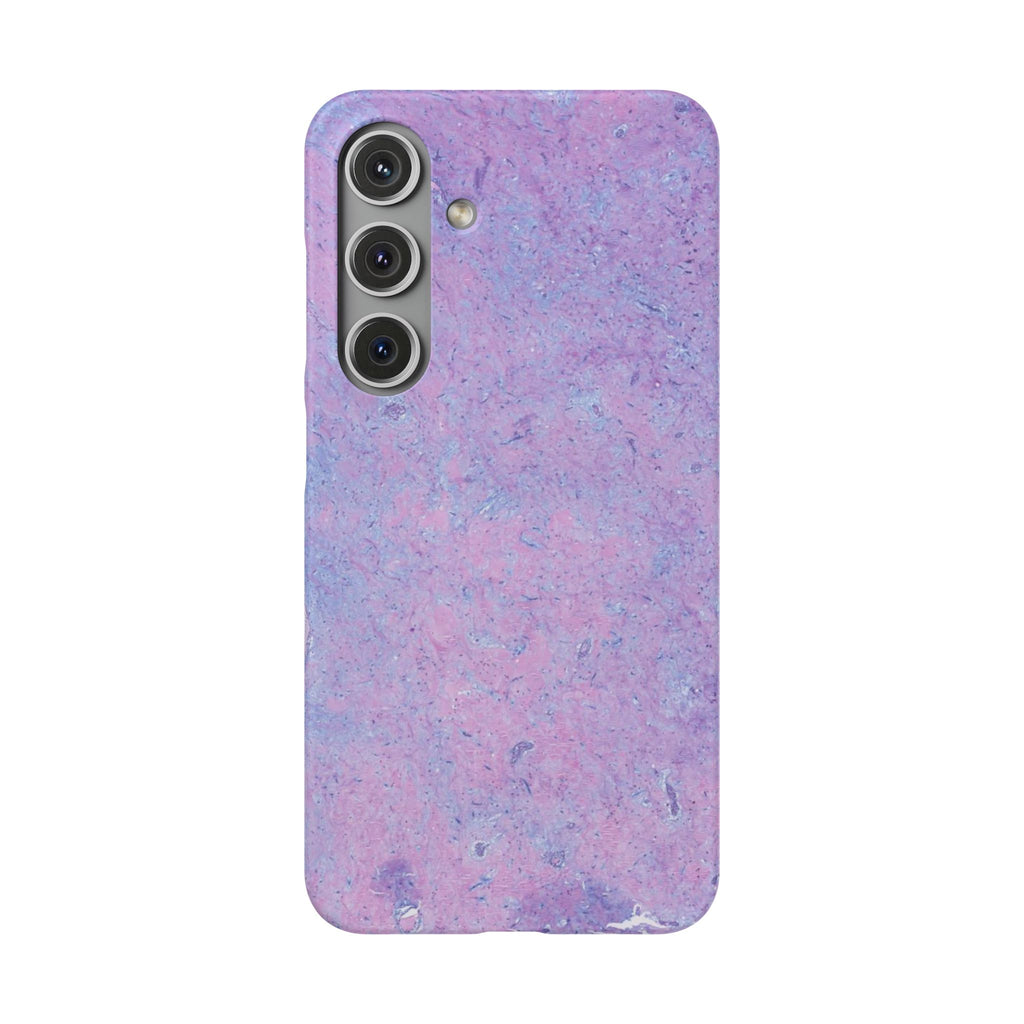 Slim Case Arterielles Myxom
