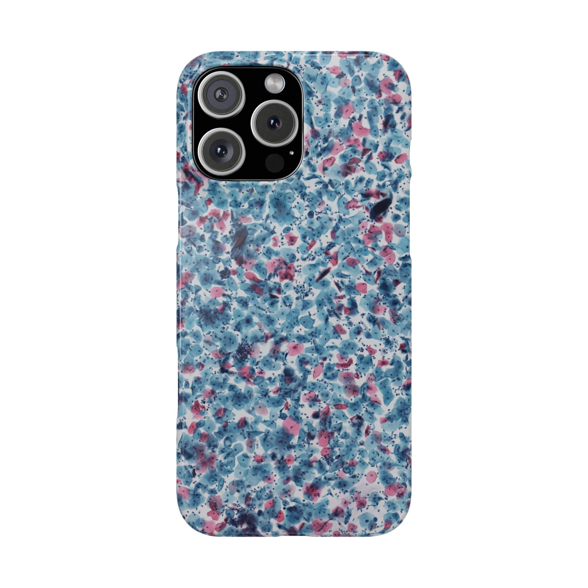 Slim Case PAP