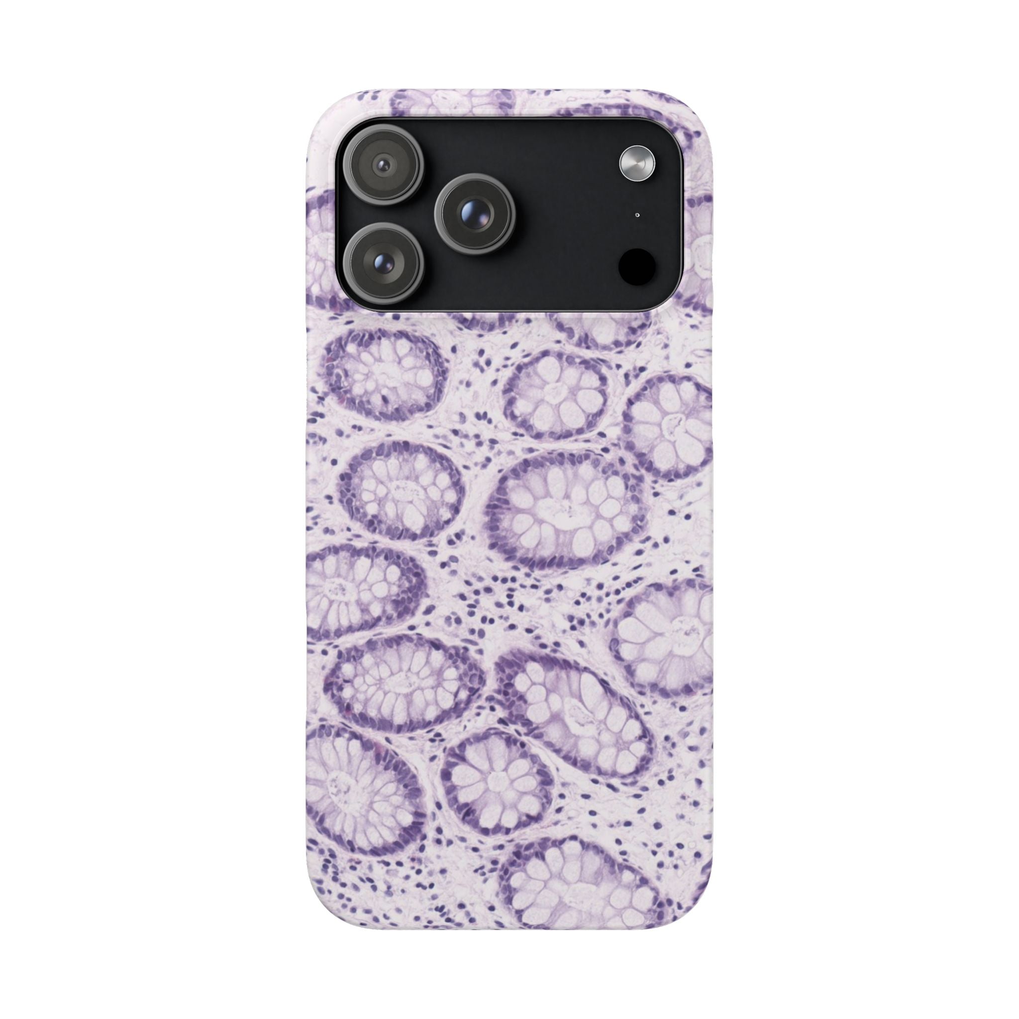 Slim Case Kolon