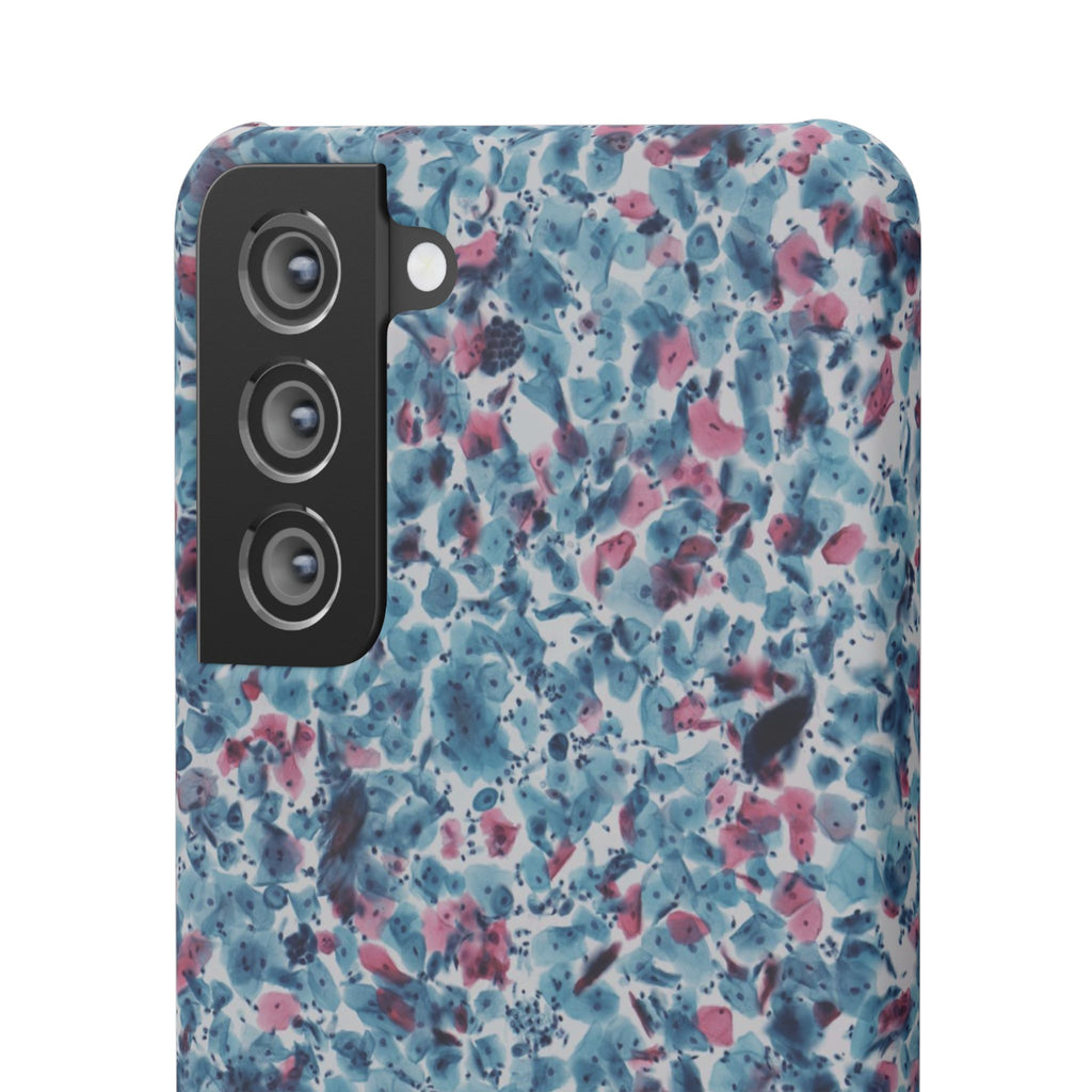 Slim Case PAP