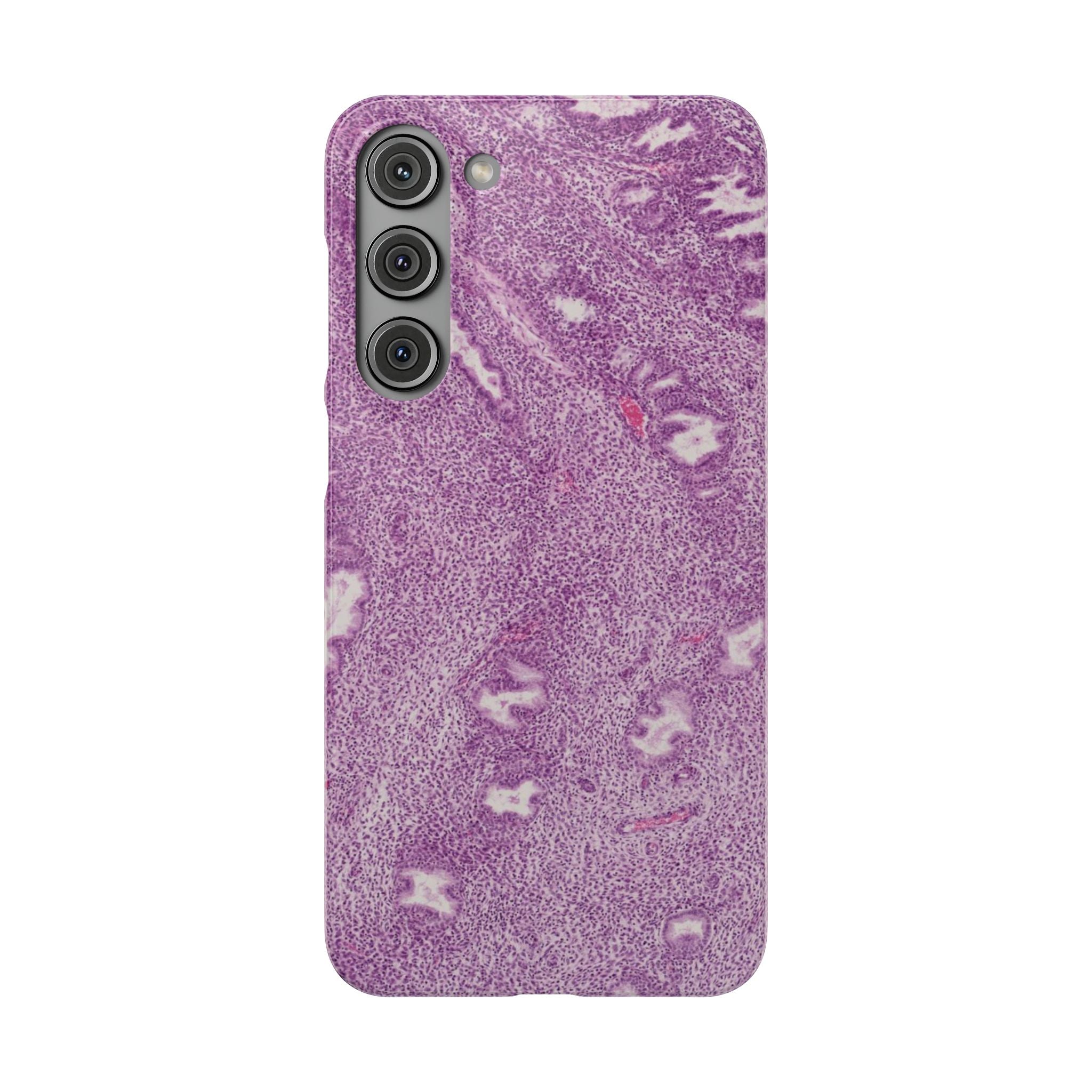 Slim Case Endometrium