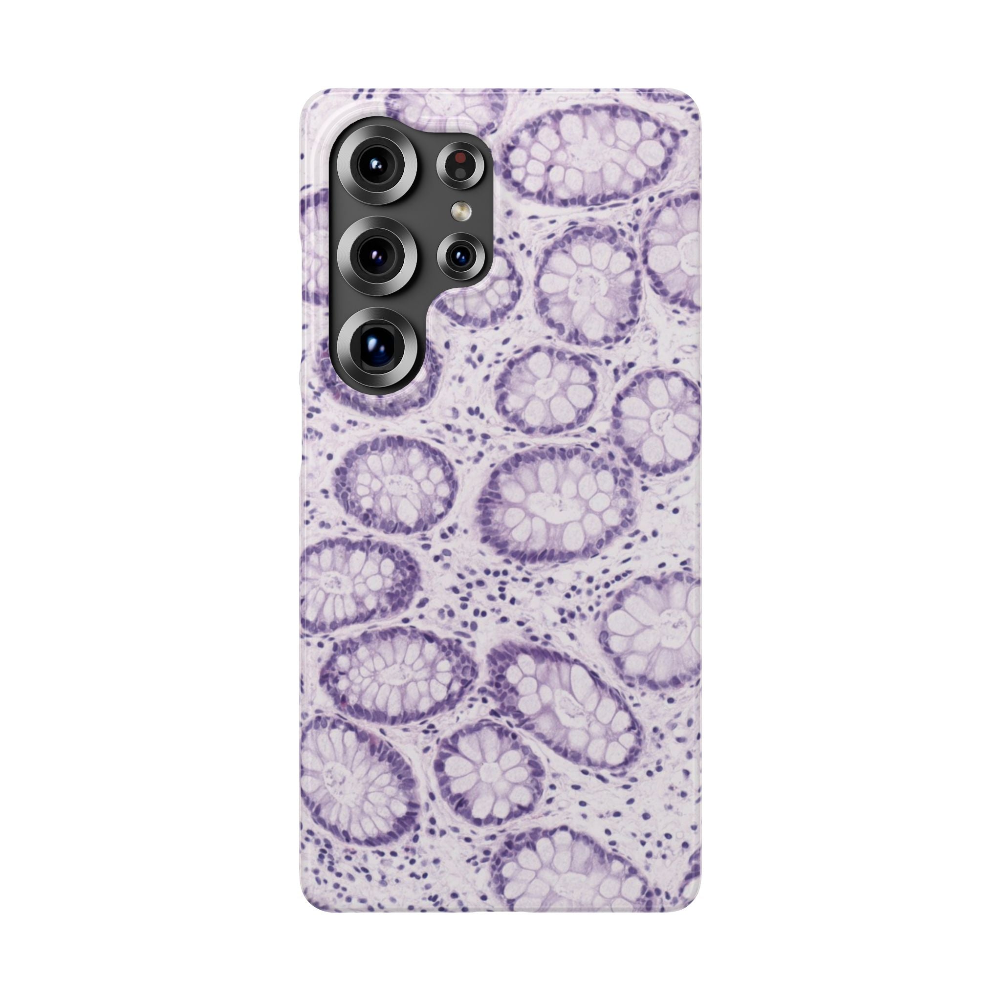 Slim Case Kolon