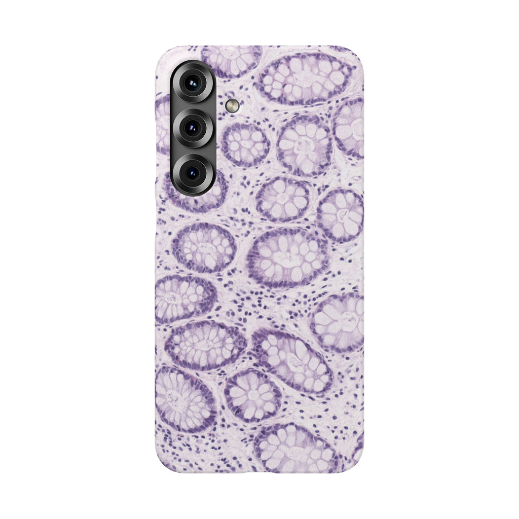 Slim Case Kolon
