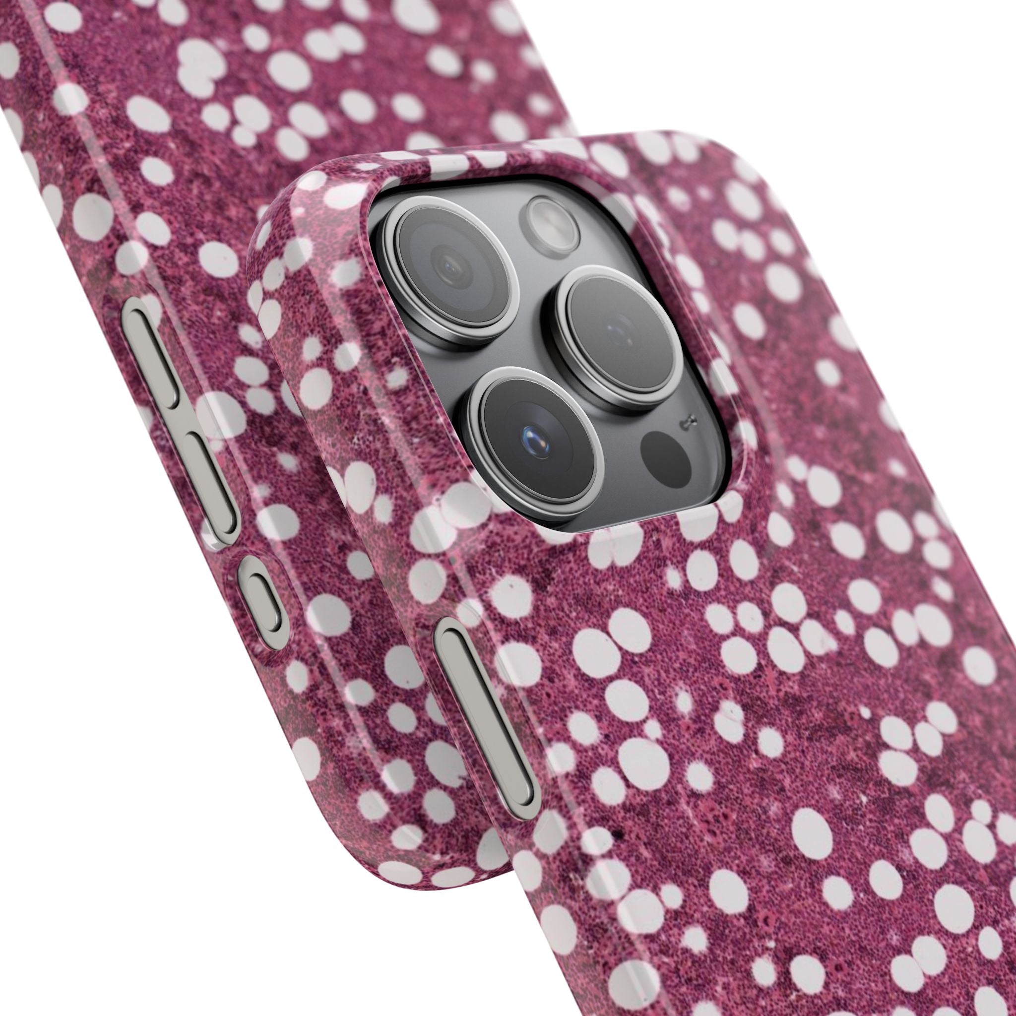 Slim Case Myelolipom