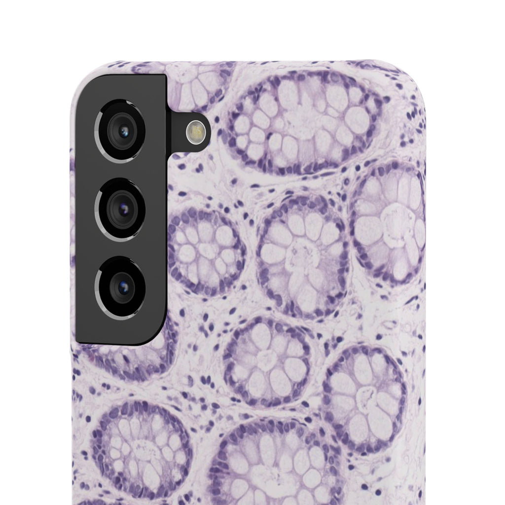 Slim Case Kolon