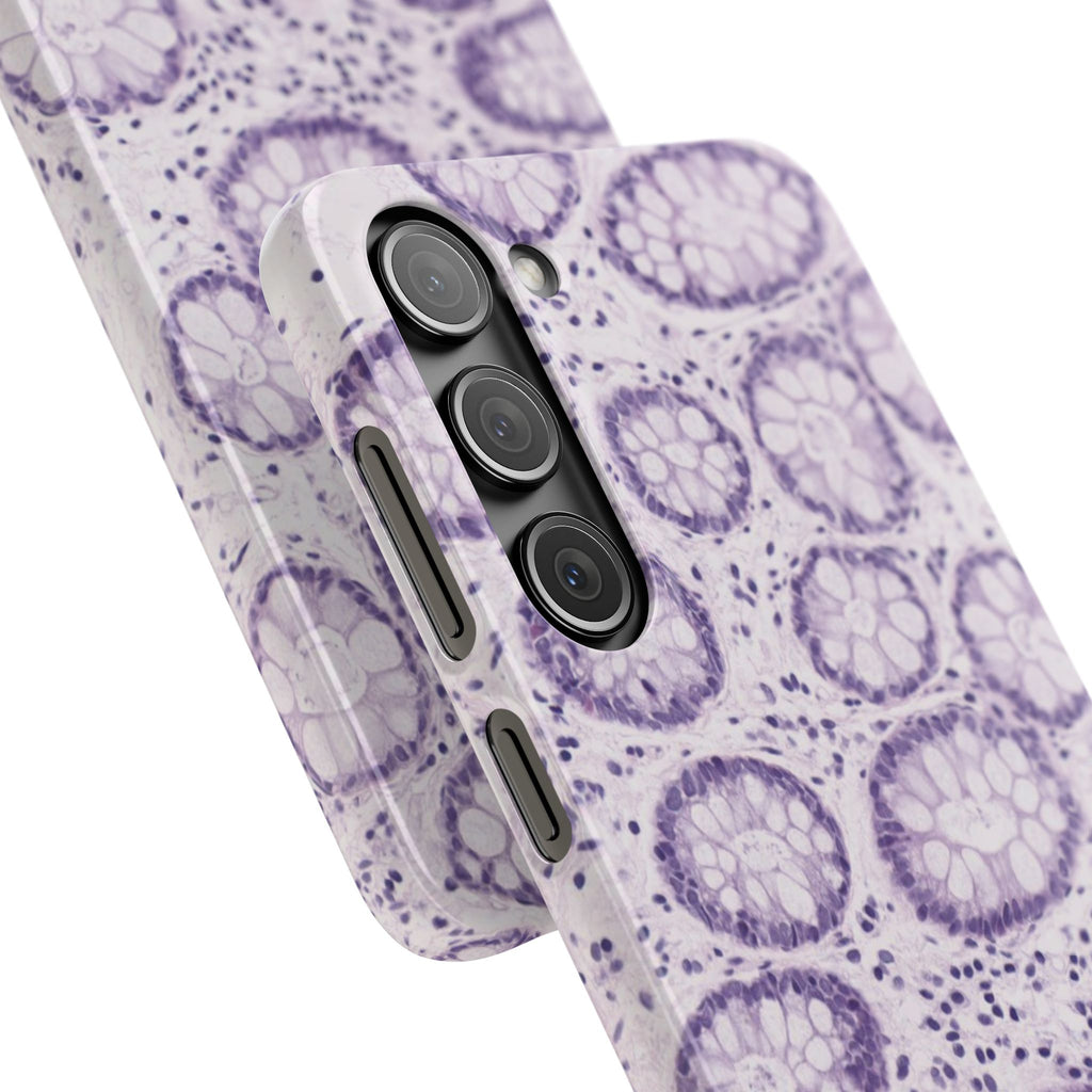 Slim Case Kolon