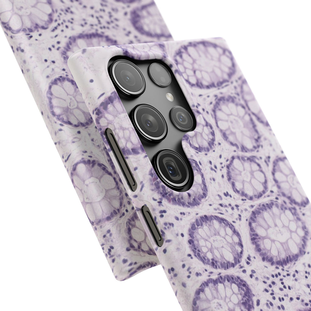 Slim Case Kolon