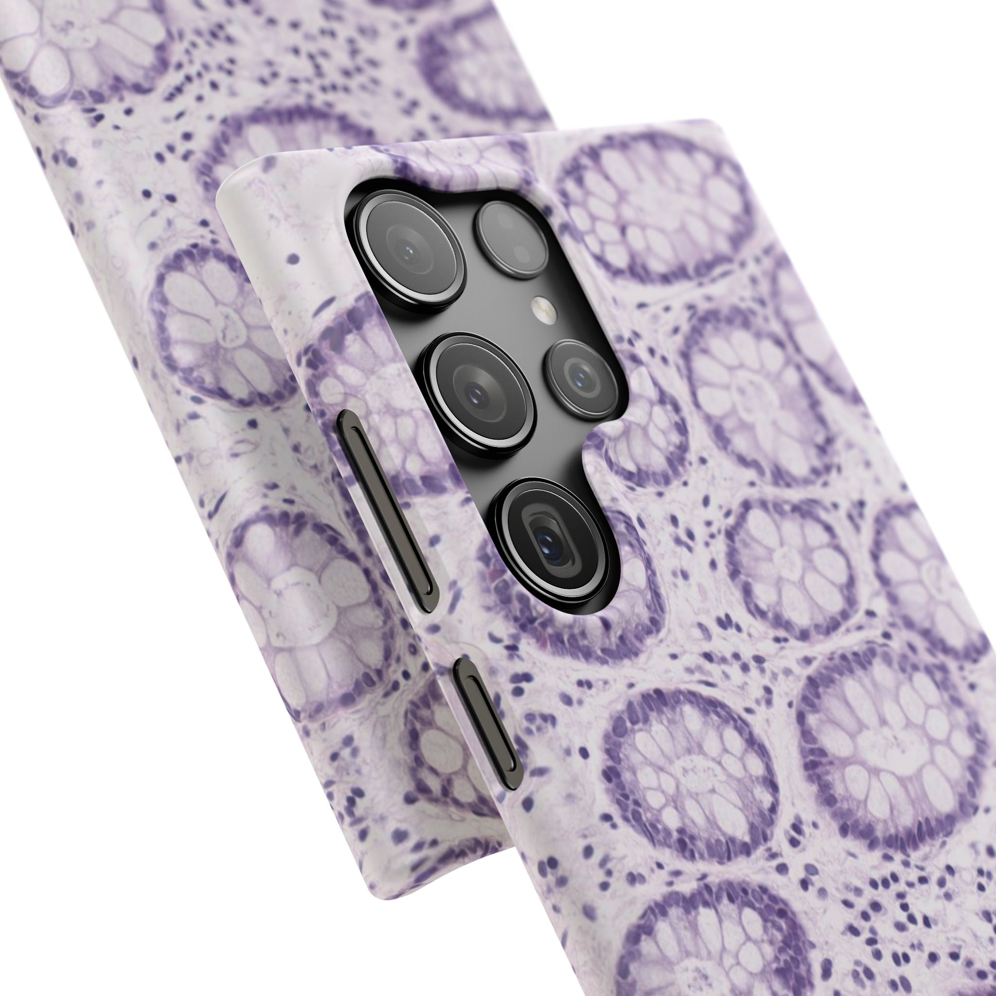 Slim Case Kolon