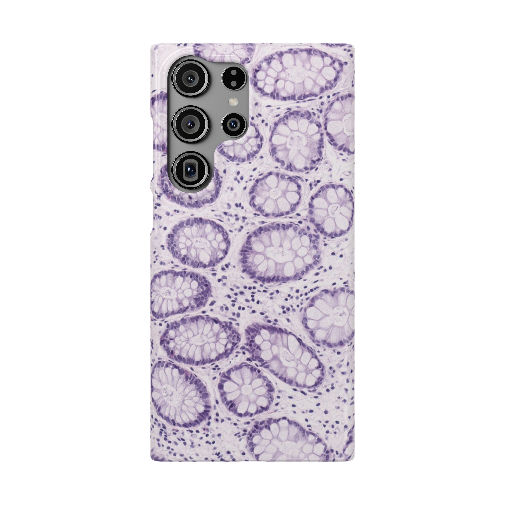 Slim Case Kolon