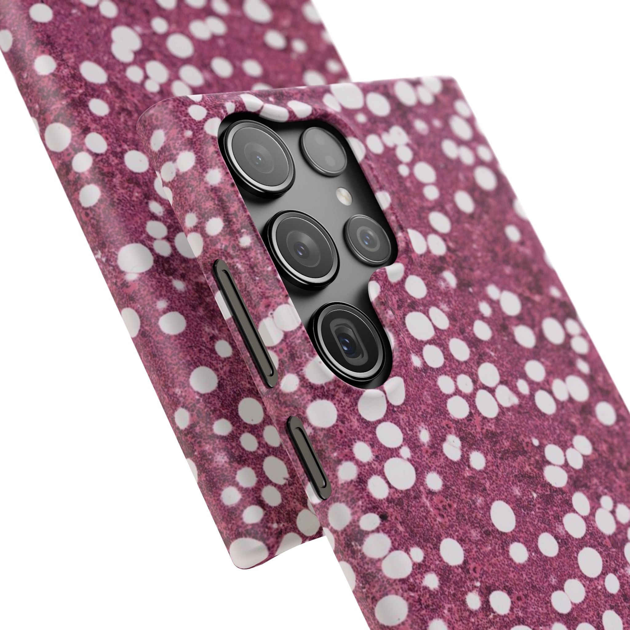 Slim Case Myelolipom