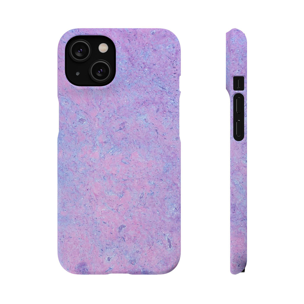 Slim Case Arterielles Myxom