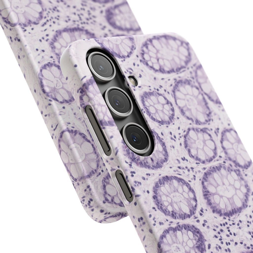 Slim Case Kolon