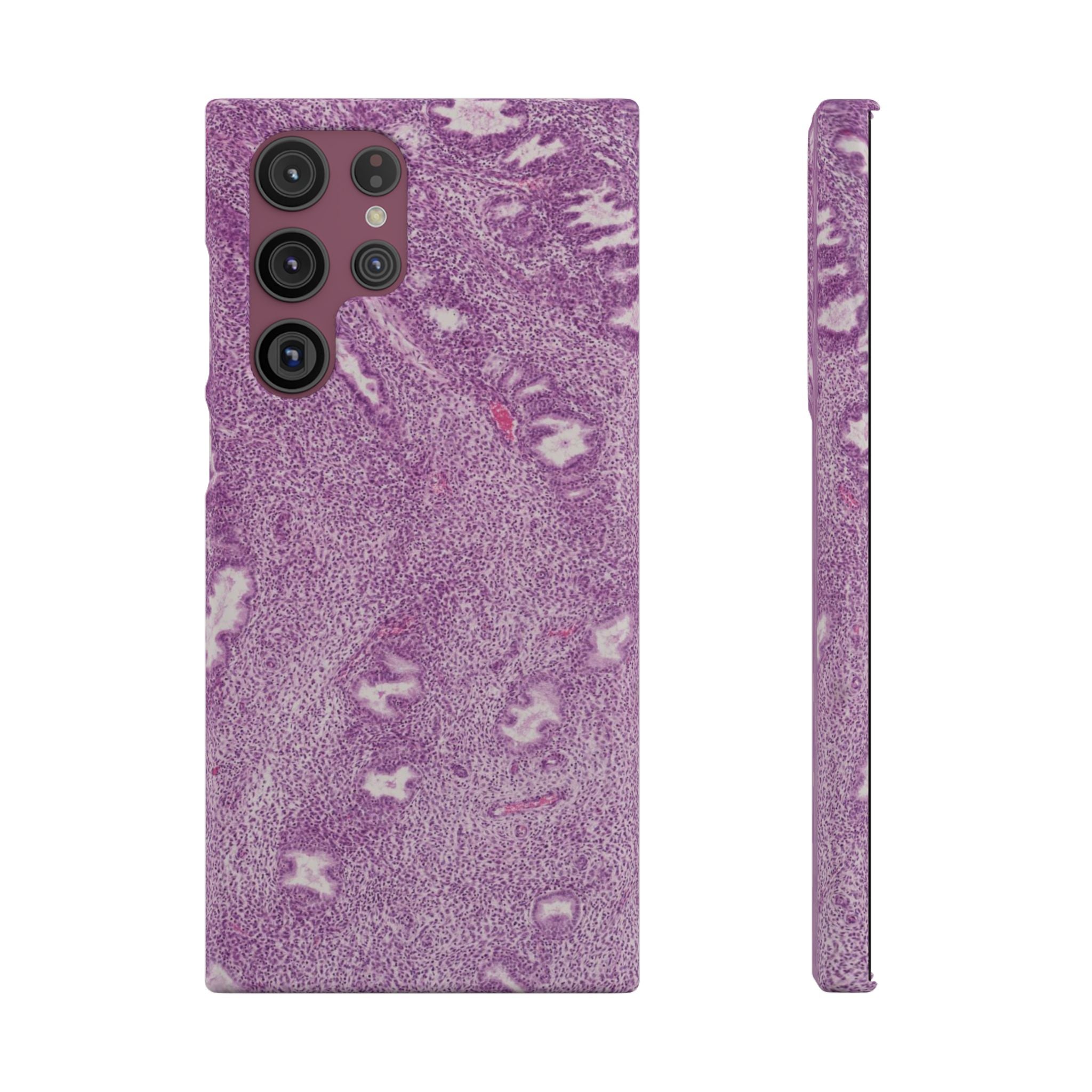 Slim Case Endometrium