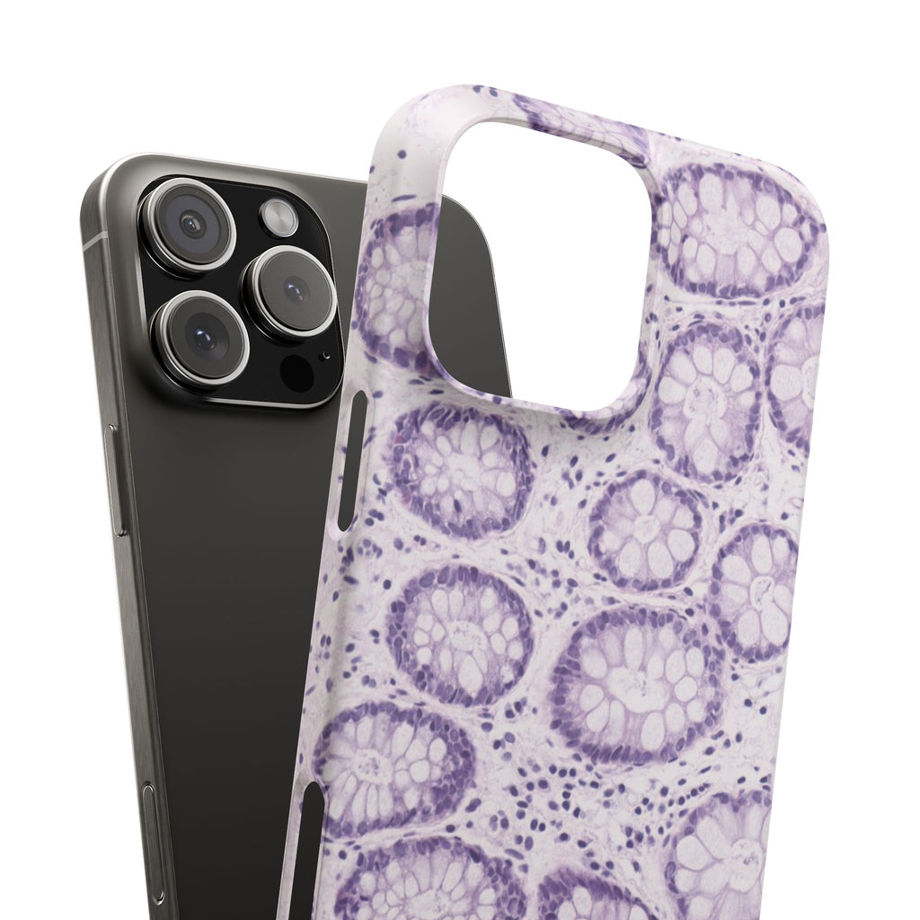 Slim Case Kolon