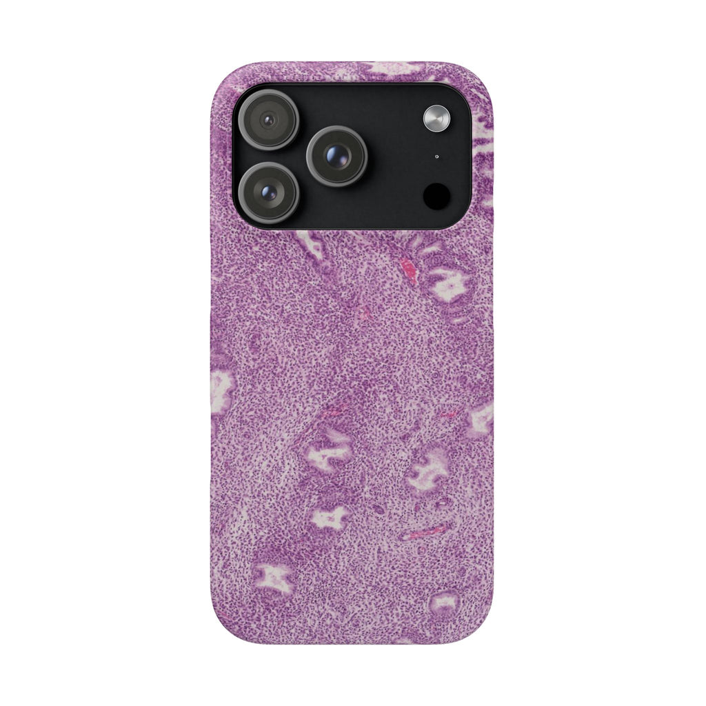 Slim Case Endometrium