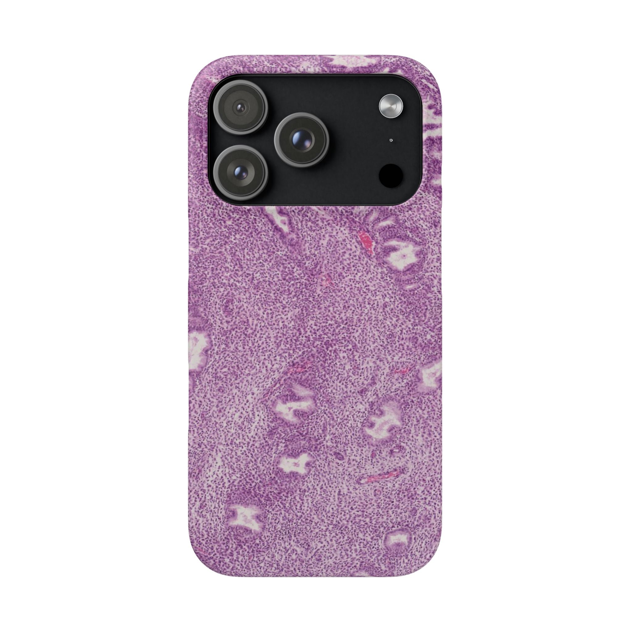Slim Case Endometrium