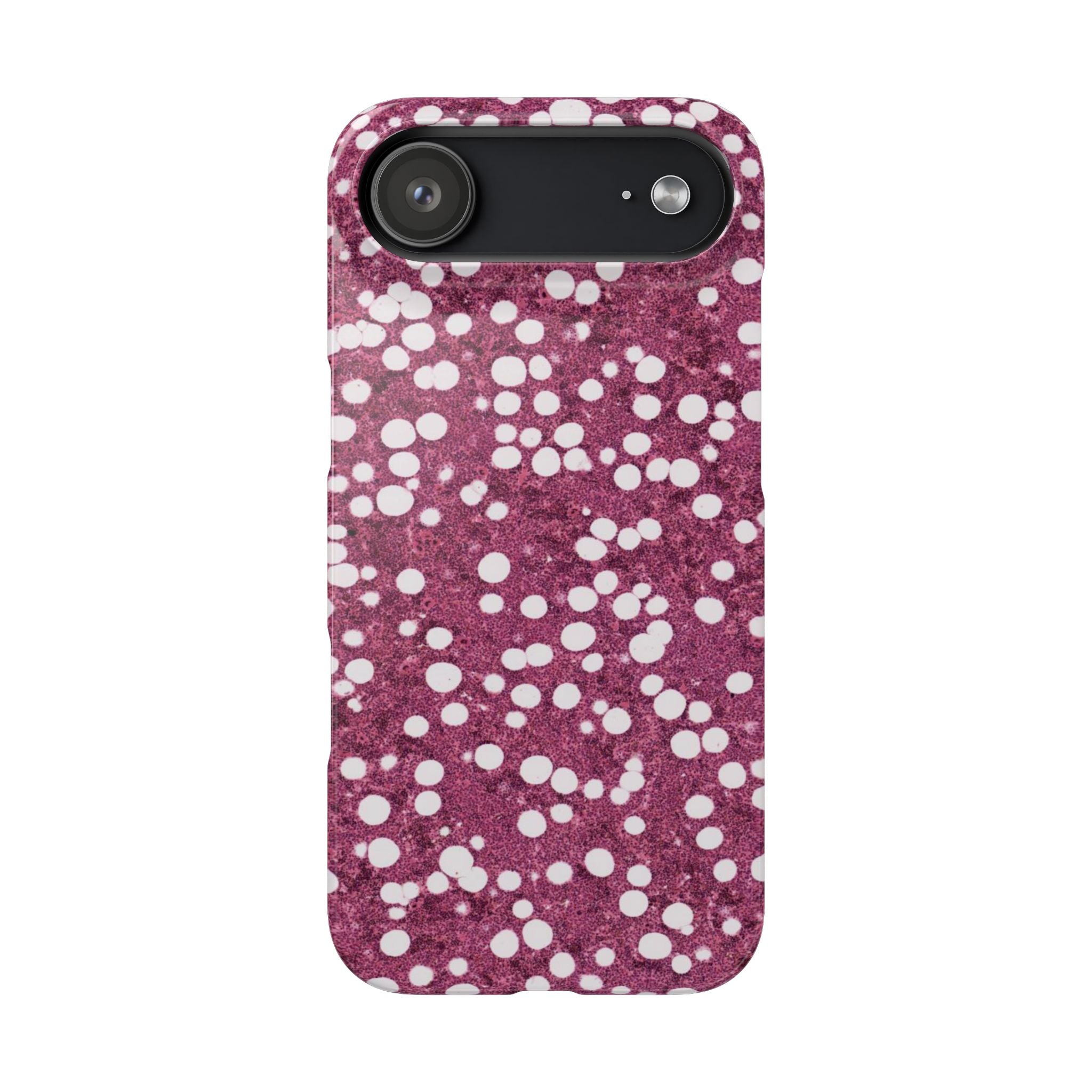 Slim Case Myelolipom