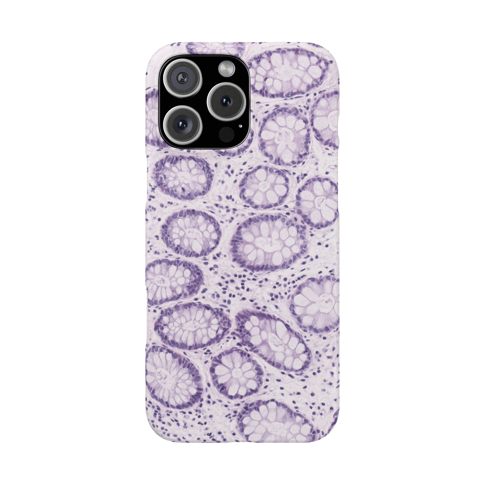 Slim Case Kolon