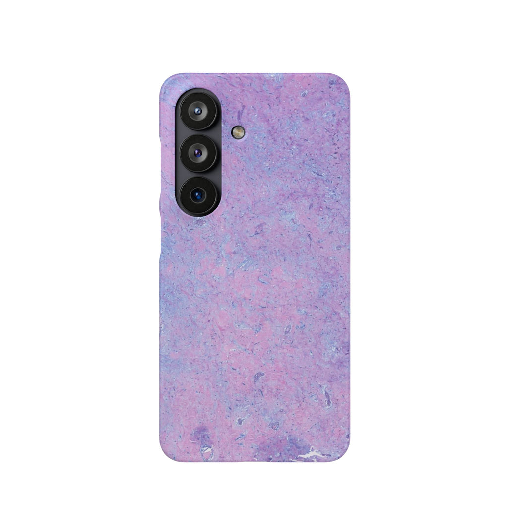 Slim Case Arterielles Myxom