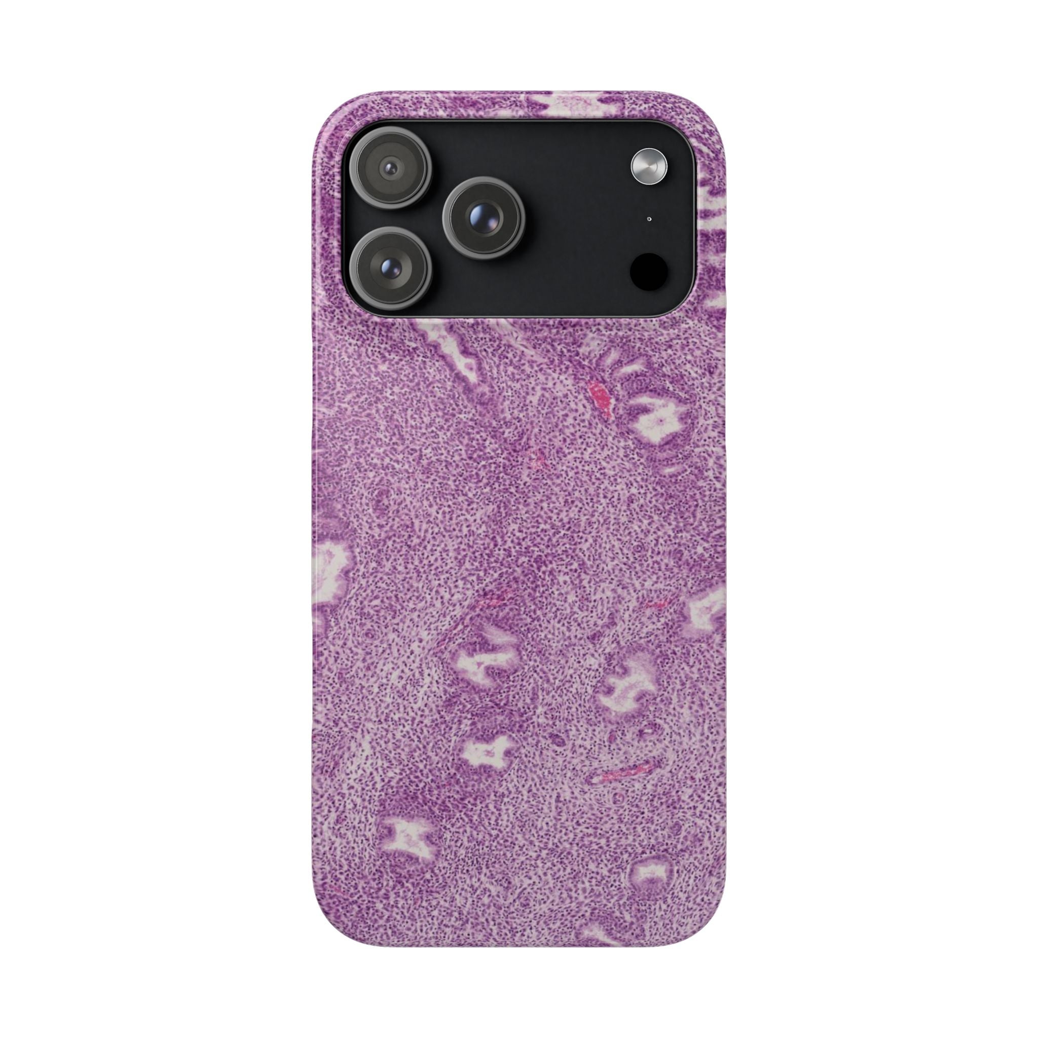 Slim Case Endometrium