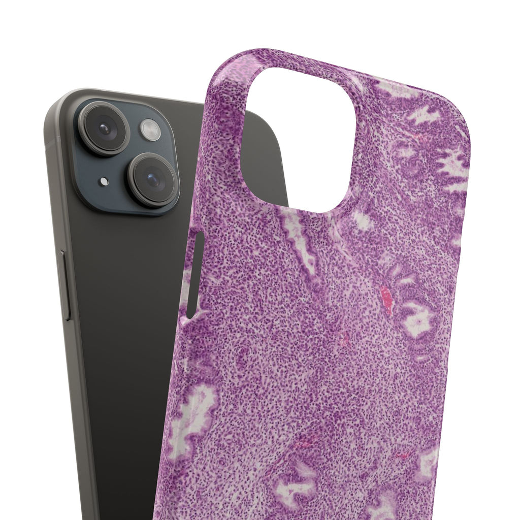 Slim Case Endometrium