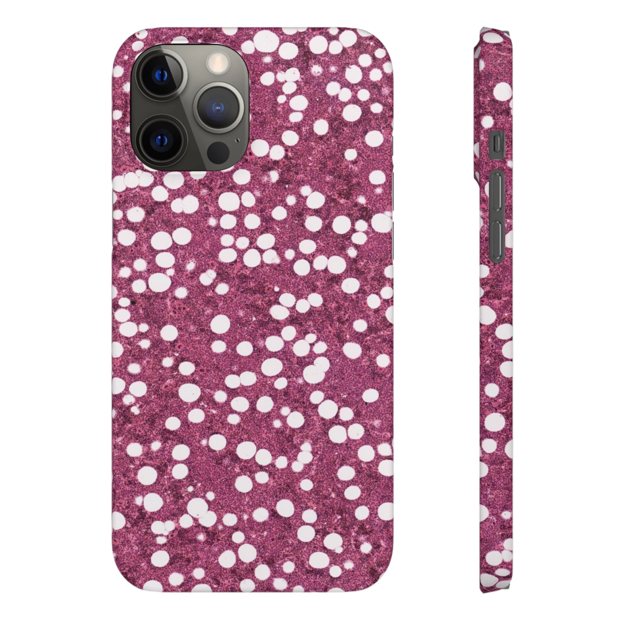 Slim Case Myelolipom