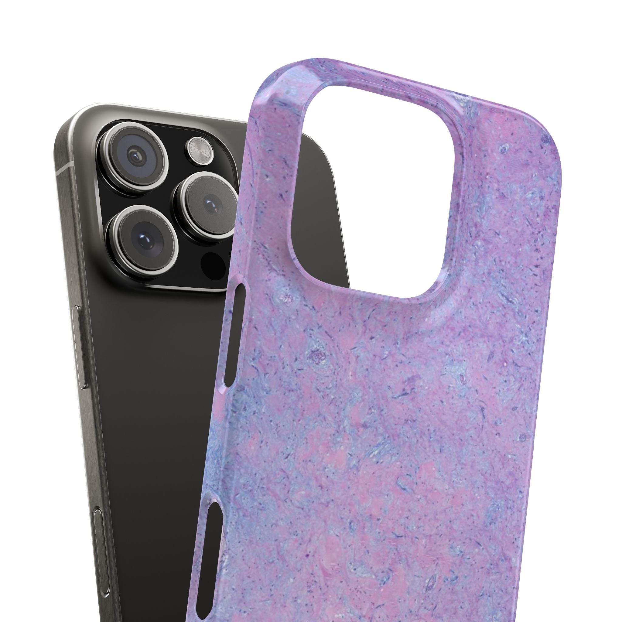 Slim Case Arterielles Myxom